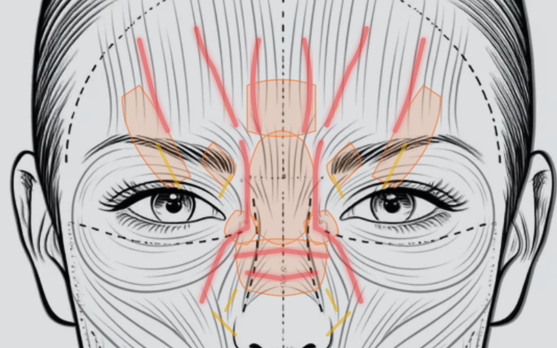 The Dalphene face chart with danger-zone overlays — arteries and caution areas highlighted around the brows, glabella, and nose